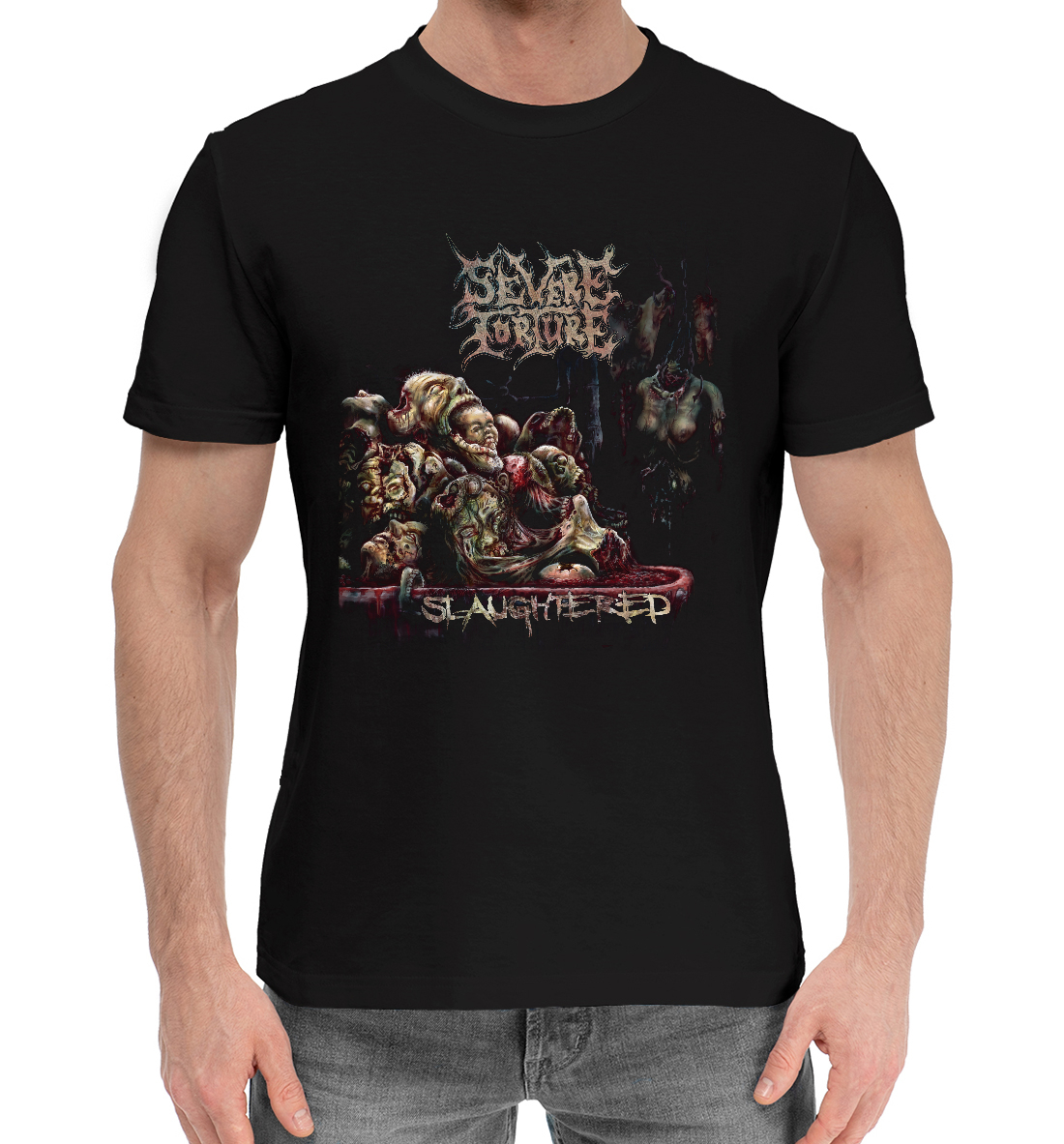 

Severet orture