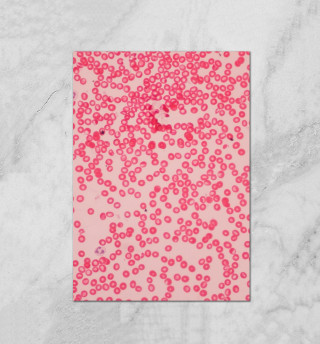 Форменные элементы крови